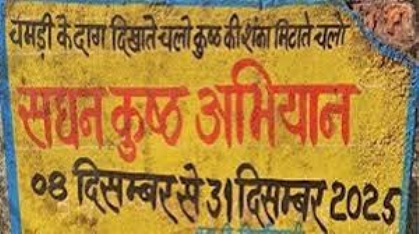 कुष्ठ जांच खोज अभियान कुष्ठ जांच खोज अभियान