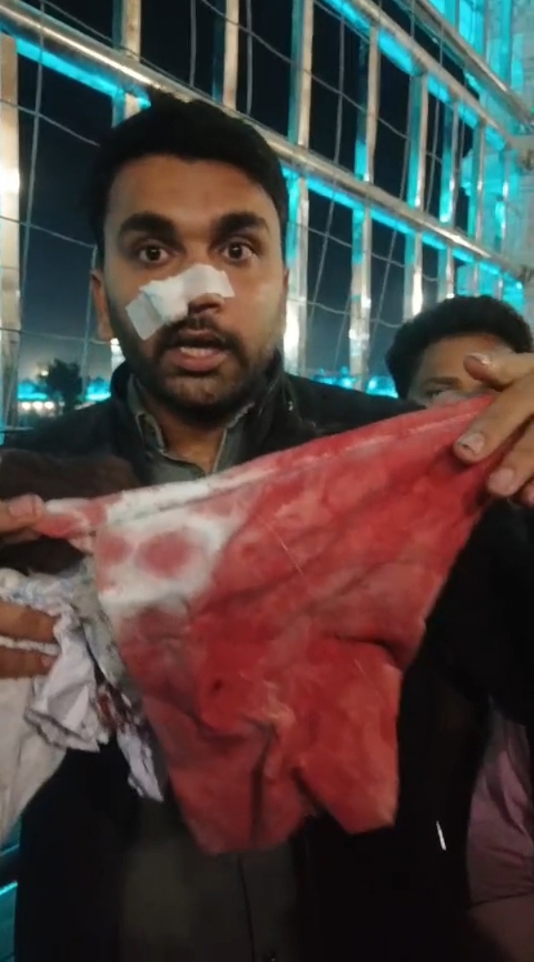 चित्तौड़गढ़ जिले के सांवलियाजी मंदिर में गार्ड की मारपीट से घायल हुआ श्रद्धालु।