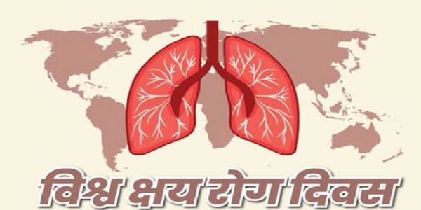 मध्यप्रदेशे अद्य विश्व-क्षय-दिवसे शत-दिवसीय-निक्षय-शिविर-अभियानस्य शुभारम्भः भविष्यति